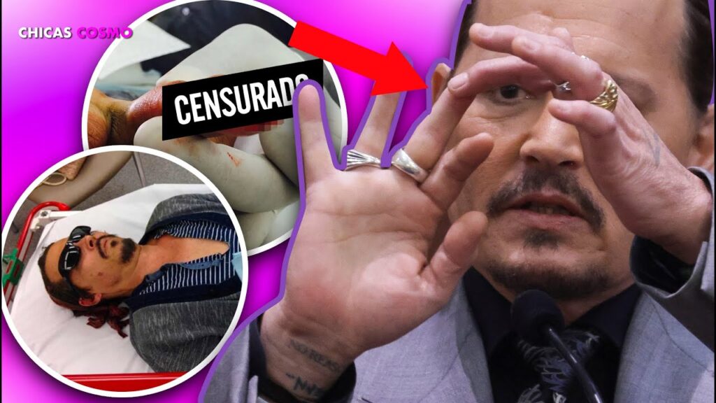 Conheça interior da casa onde Johnny Depp teve dedo decepado Johnny Depp mostra dedo acidentado no tribunal Reproducao YouTube