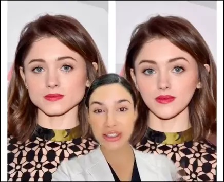 Captura de Tela do video em que Miranda Wilson mostra antes e depois caso Natalia Dyer fizesse o procedimento estetico Reproducao TikTok
