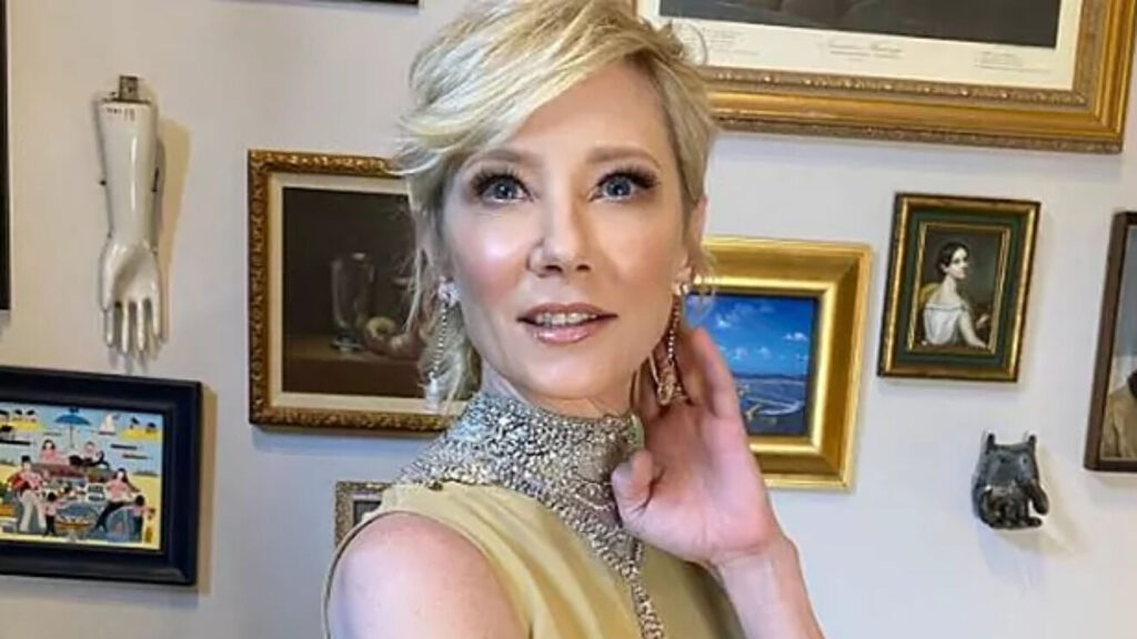 Anne Heche tem morte cerebral declarada e órgãos poderão ser doados Anne Heche Reproducao Instagram