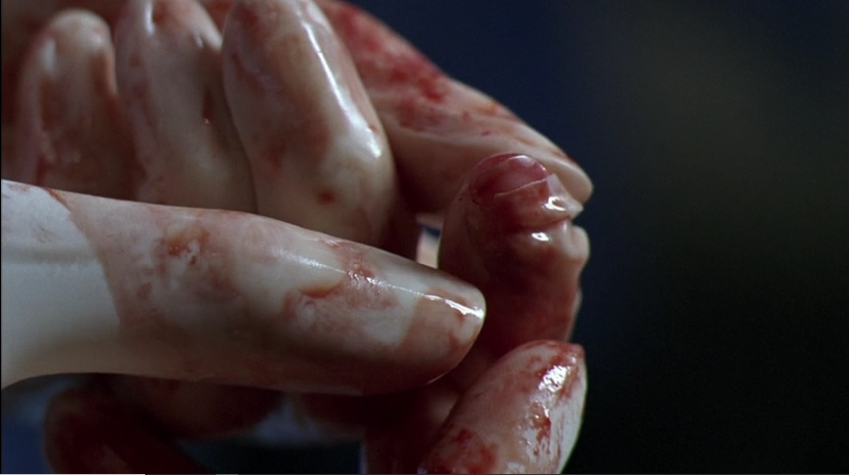 Relembre o primeiro (e absurdo) erro médico de Meredith em Grey's Anatomy 2 Mão de Meredith Grey em Grey's Anatomy