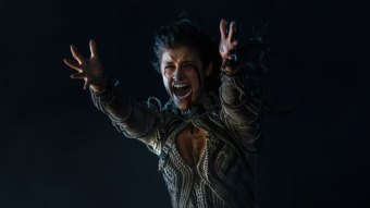 Yennefer (Anya Chalotra) em The Witcher (Reprodução / Netflix)
